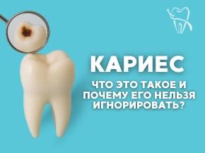 Кариес: что это, откуда берется и почему с ним нужно бороться вовремя