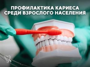 Научная статья: Профилактика кариеса среди взрослого населения