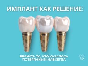 Имплантология: решение есть всегда