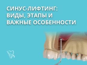 Все, что нужно знать о синус-лифтинге